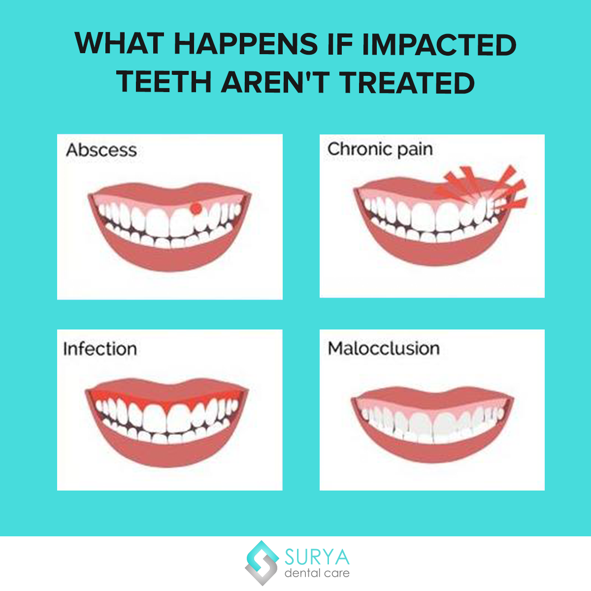 Wisdom teeth food timeline